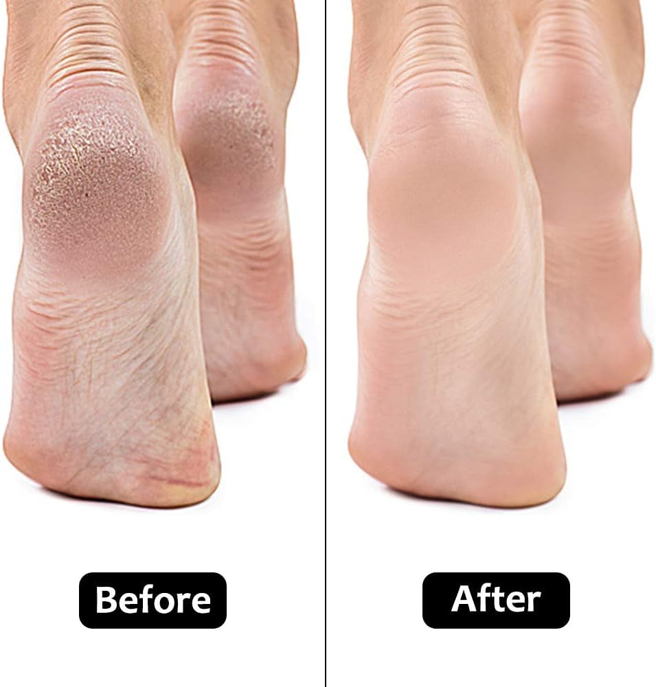 Electronic Foot File Grinder with 60Pcs Replacement Sandpaper Disk, Powerful Electric Callus Remover Professional Pedicure Tool for Men Women Dead Cracked Hard Skin Calluses