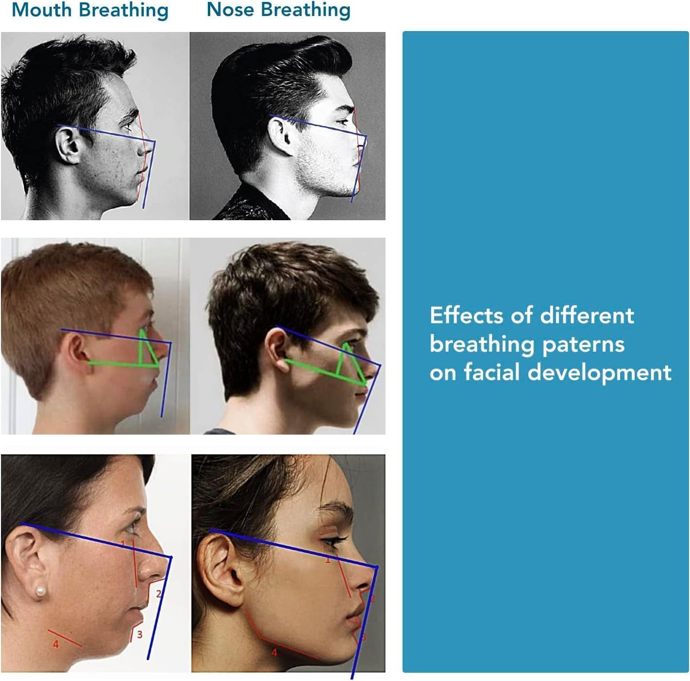 Glam 60 Pack Mouth Tape for Sleeping - Pain Free Removal, Hypoallergenic, Latex Free & Gentle on Skin - Skin Friendly Adhesive Cotton Tape