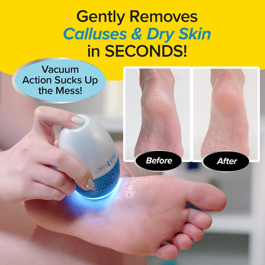 As Seen on TV Electric Callus Remover + Built-In Vacuum Sucks up Shavings,Gently Removes Calluses & Dry Skin in Seconds, Mess-Free, Spins at 2000 Rpms, LED Light, 2 Speed Settings, 3.5"X 2.5"